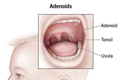 adenoidid